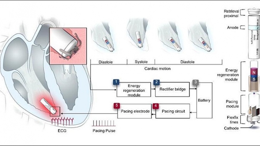 Các nhà khoa học Trung Quốc phát triển máy tạo nhịp tim tự cấp điện siêu nhỏ